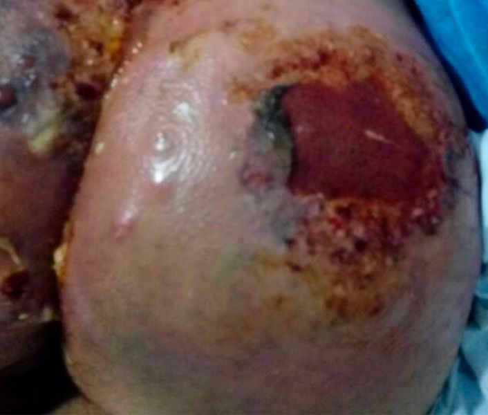 amputated-arms-post-copy